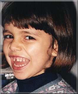 Os Meus dentes continuam a cair....